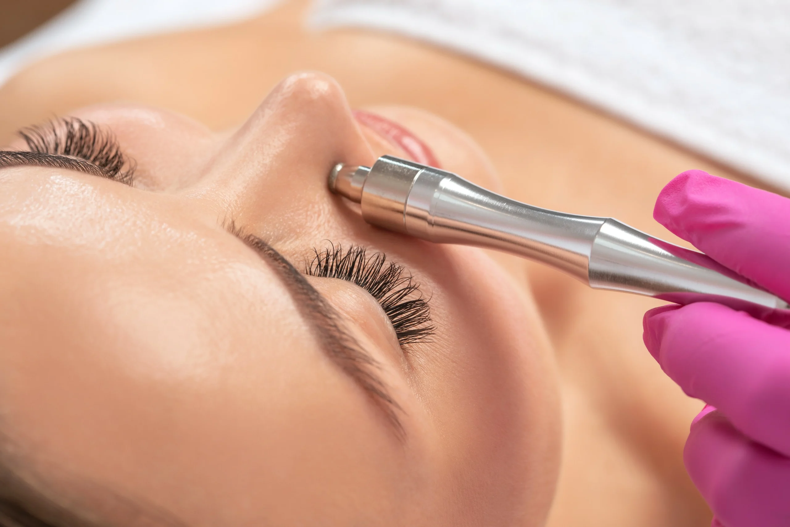 Hydro microdermabrasion scaled